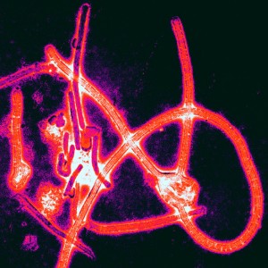 Color-enhanced electron micrograph of Ebola virus particles. 